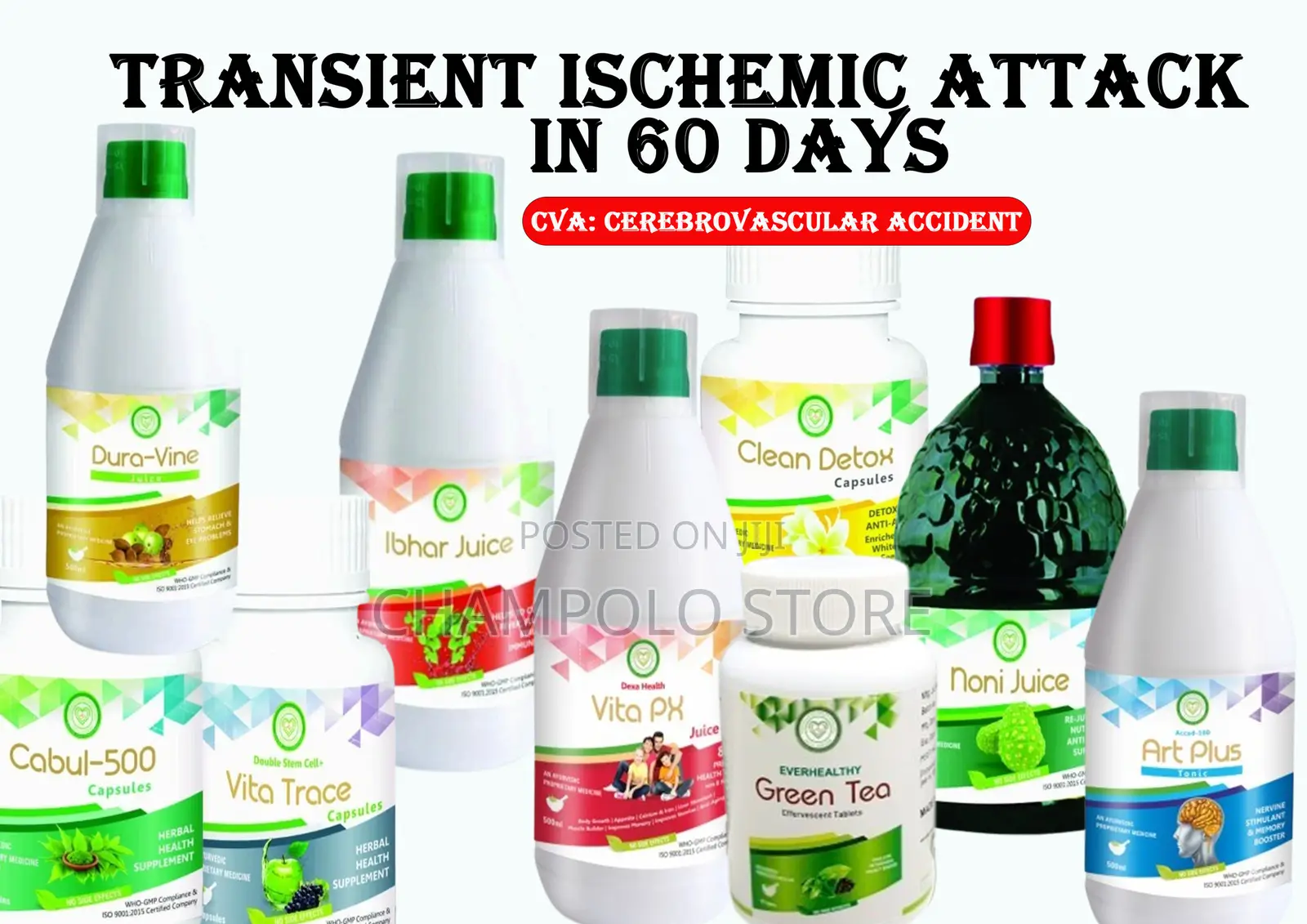 Transient Ischemic Attack