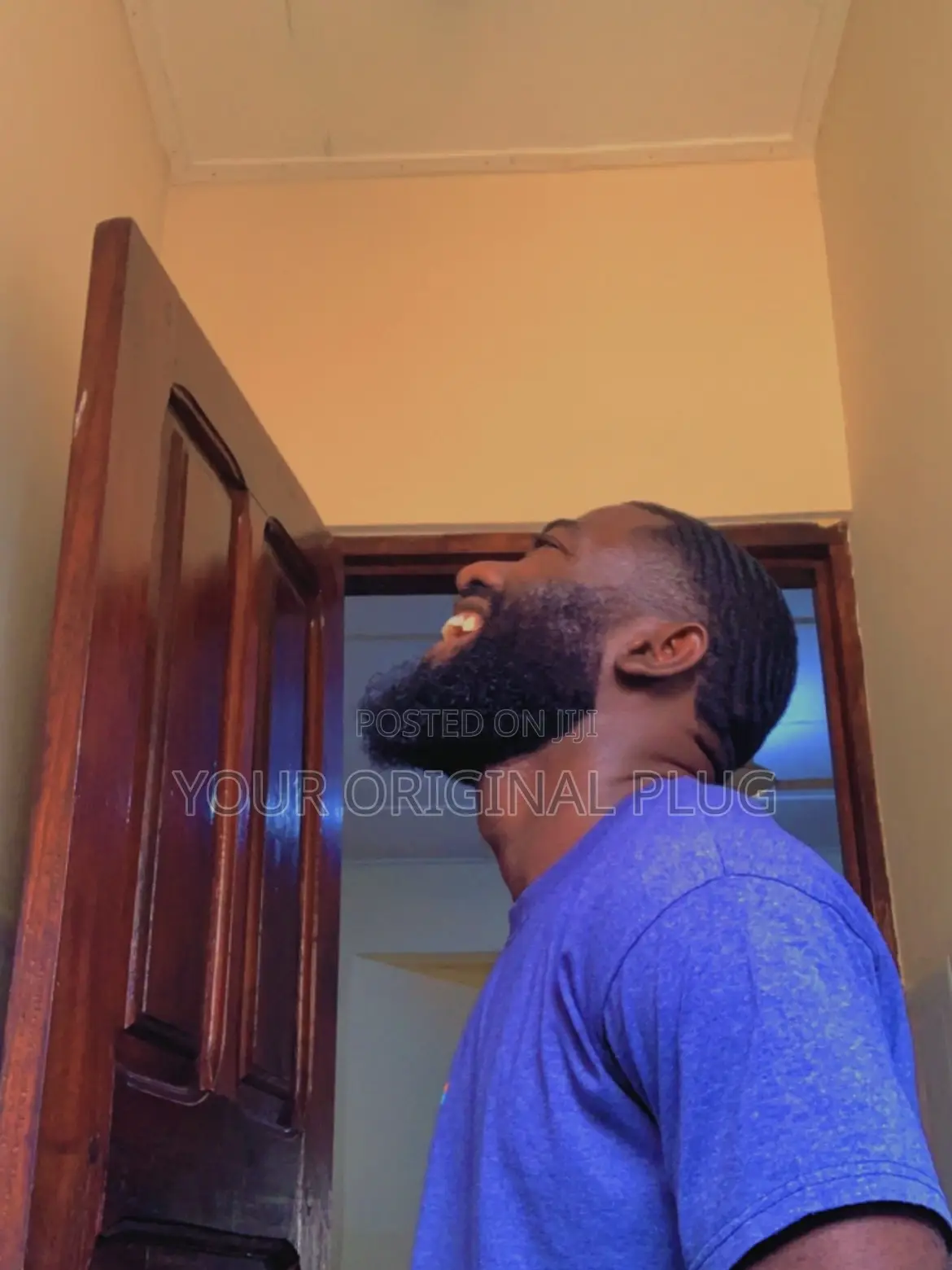Stronger Beard,Fuller Hair—Kirkland Minoxidil + Derma Roller