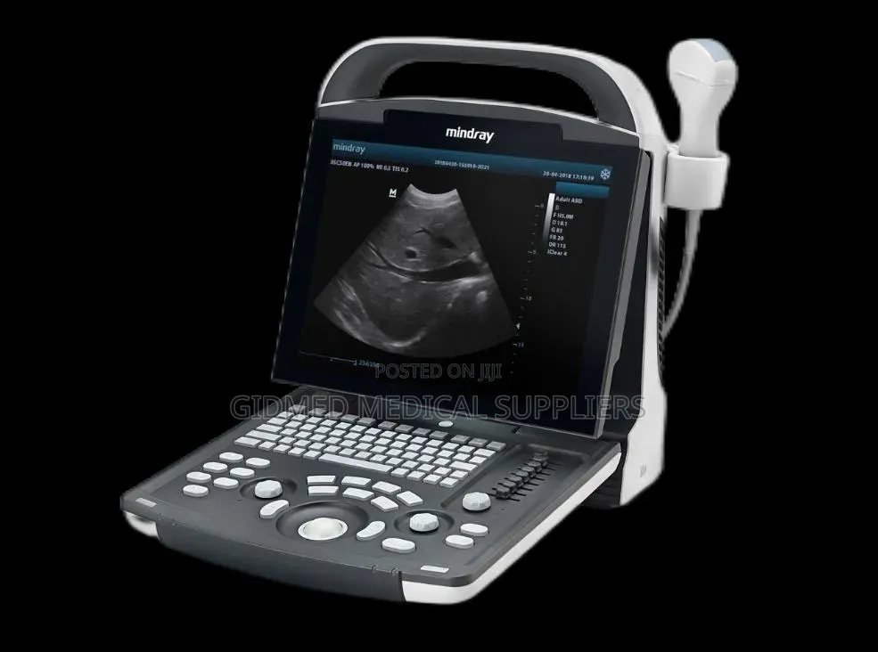 Ultrasound Machine Dp 10