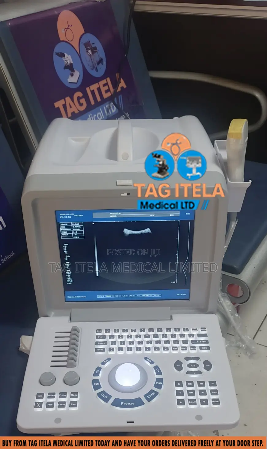 Ultrasound Machine (2d Tabletop With Single Probe)