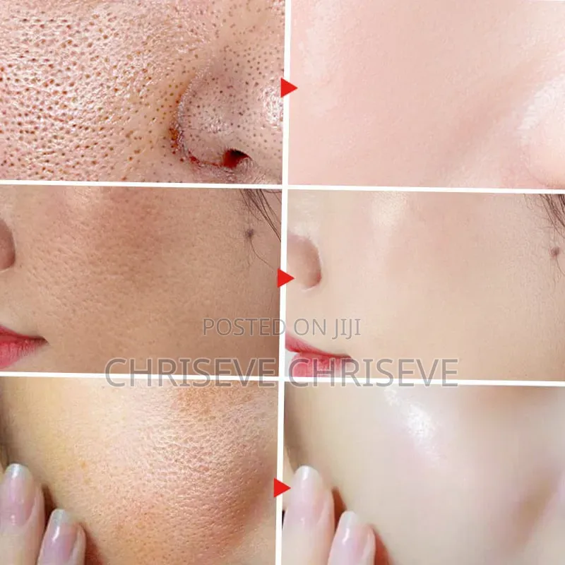 Hyalucera Acid Gel for Anti-Aging