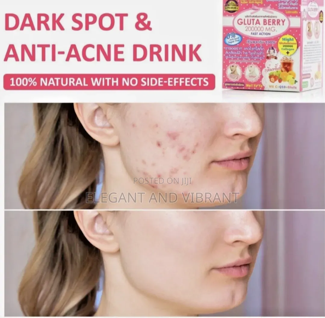 Anti Aging, Winkles, Dark Spots, Anti Ace Drink 2000mg,Skin Whitening