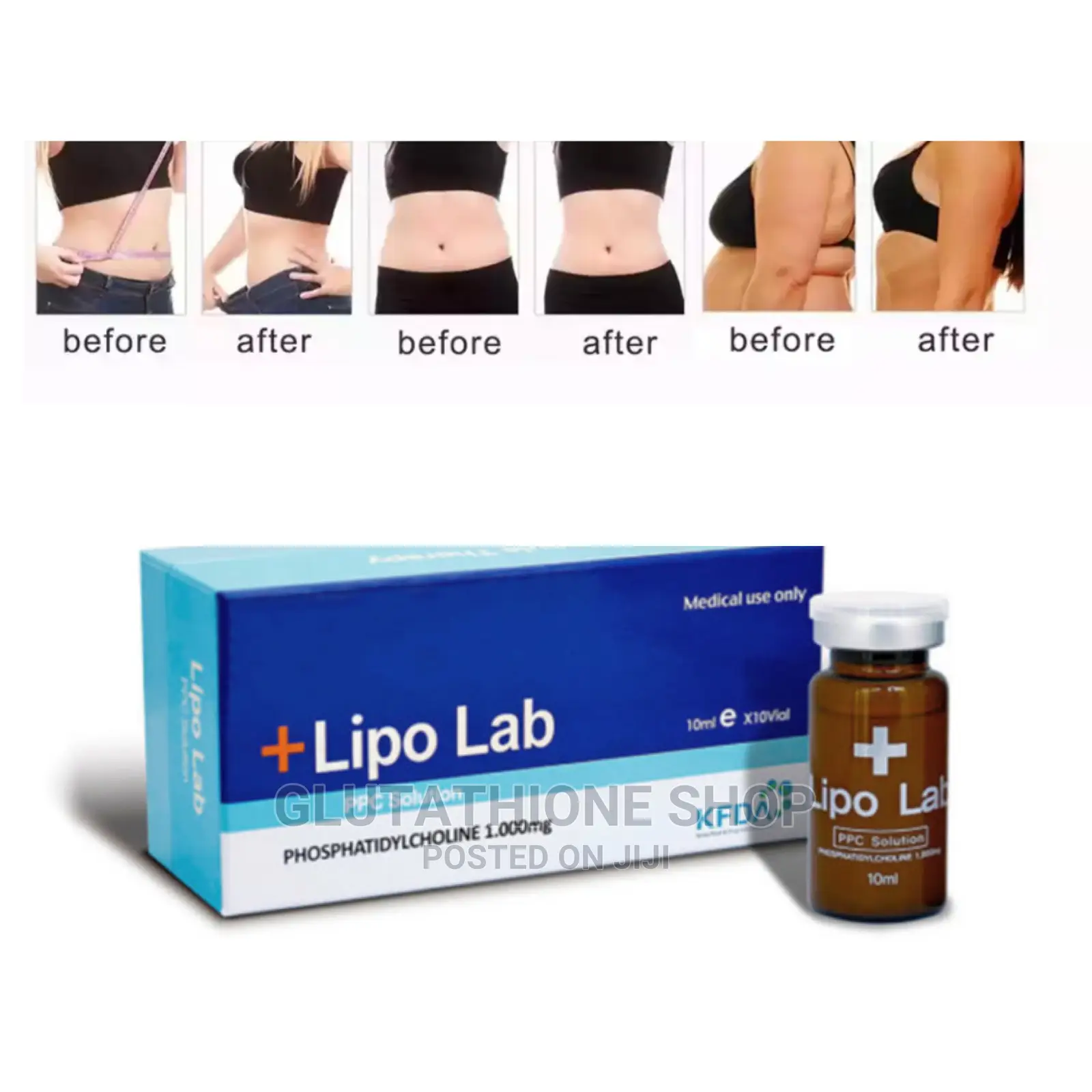 Lipo Lab PPC Fat Melting Injection