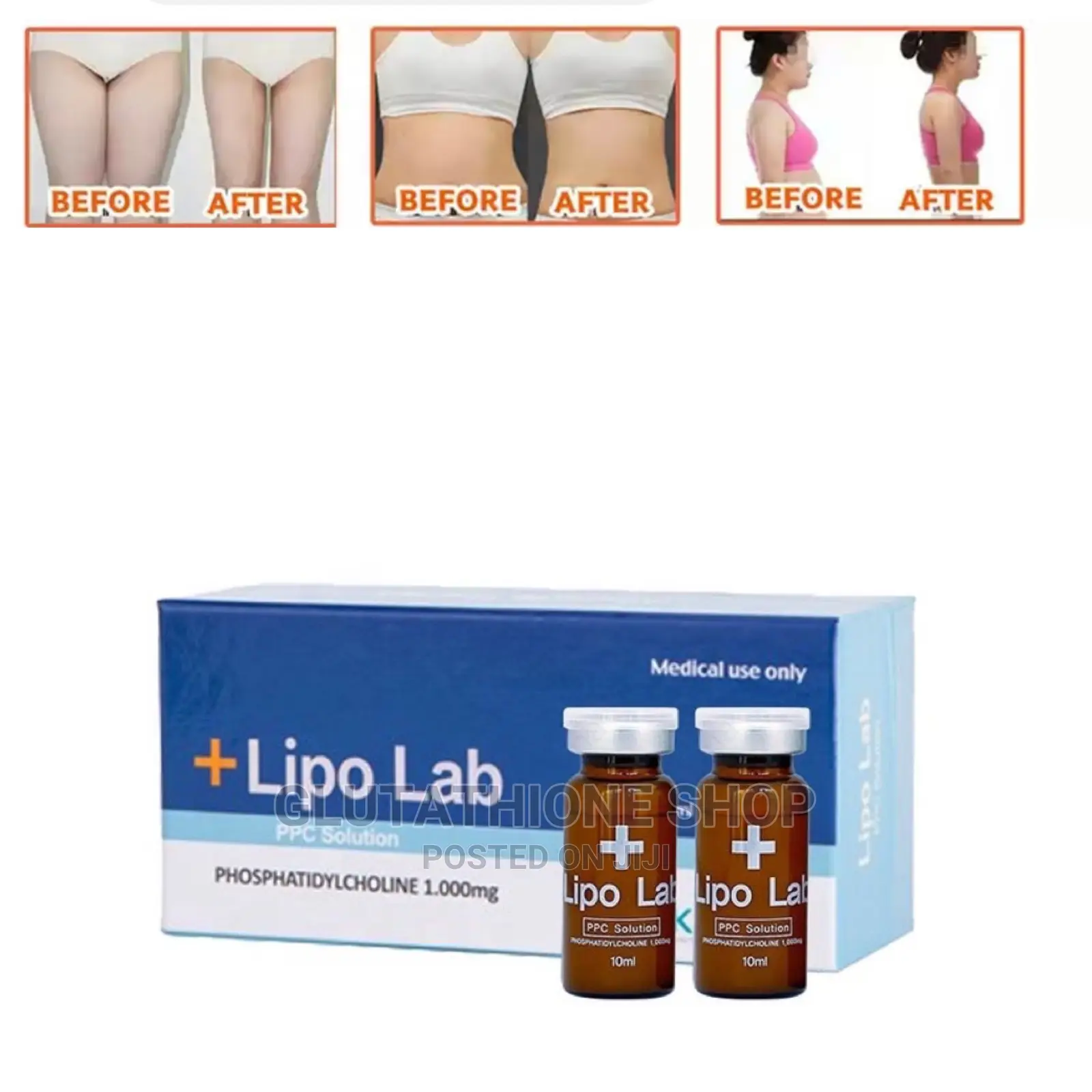 Lipo Lab PPC Fat Melting Injection