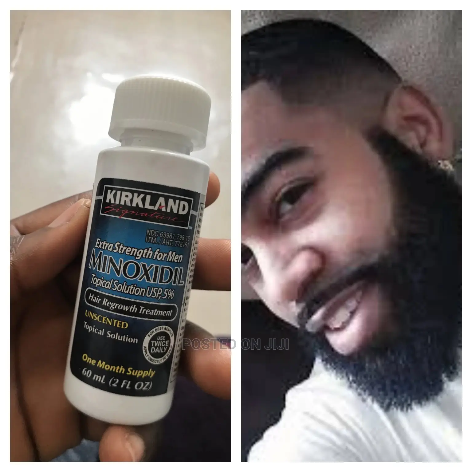 Leo Kirkland Minoxidil Oil