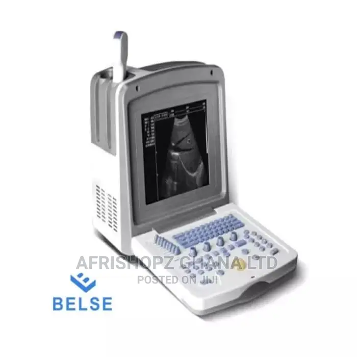 Ultrasound Scan