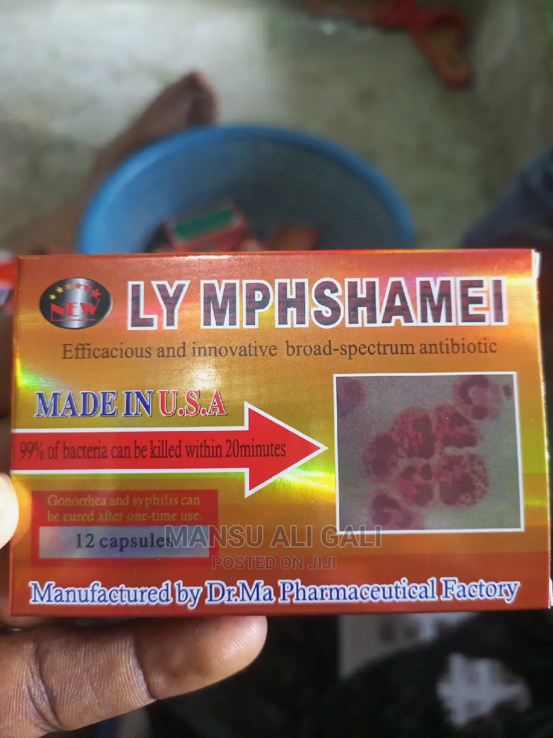 Lymphshamei for STDS
