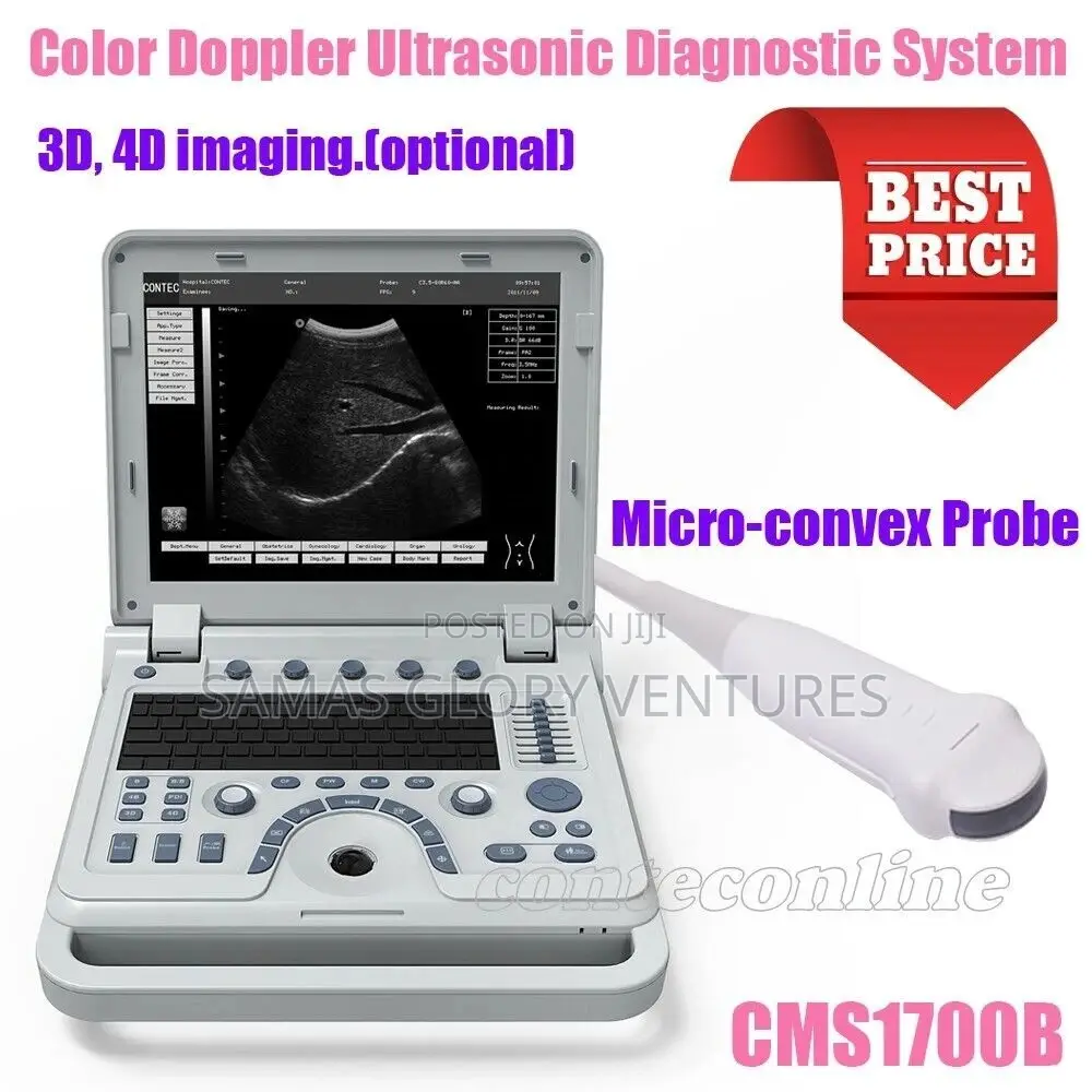 Ultrasound Machine