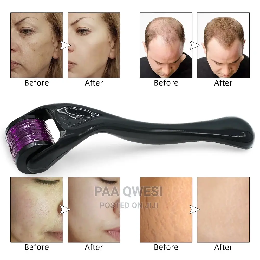 Derma Roller Growth Device {1.5mm}