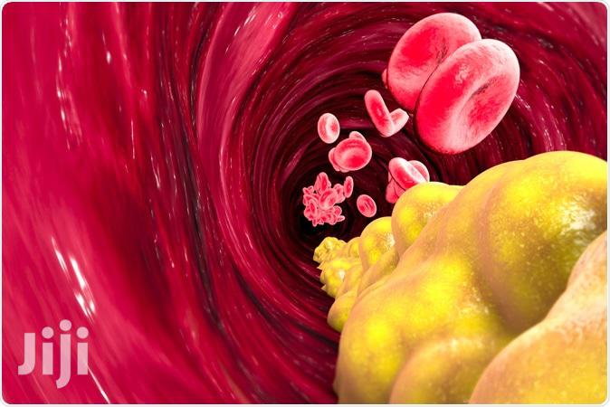 Natural Solution For High Blood Pressure