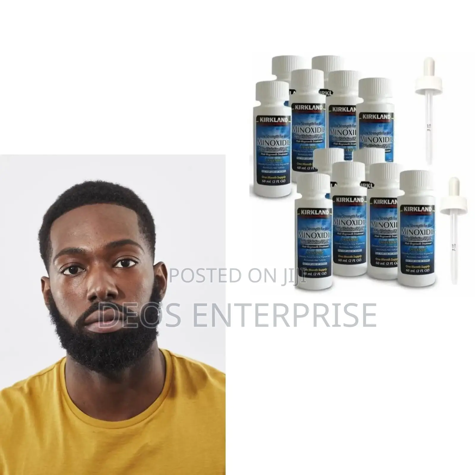 Kirkland Minoxidil Oil for Beard,Hairline and Baldness