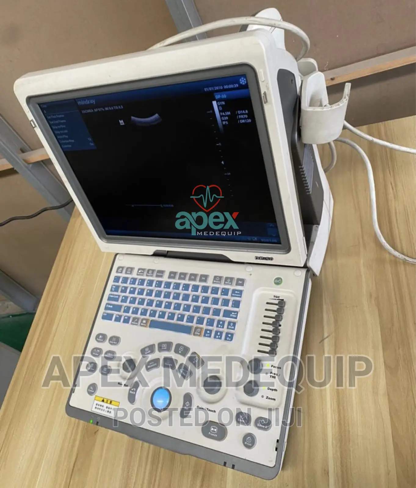 Mindray DP 50 Ultrasound Scan ( Home Used,Great Condition)