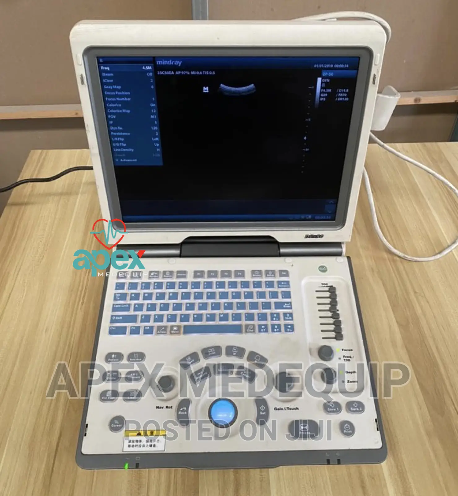 Mindray DP 50 Ultrasound Scan Machine + 1 Convex Probe