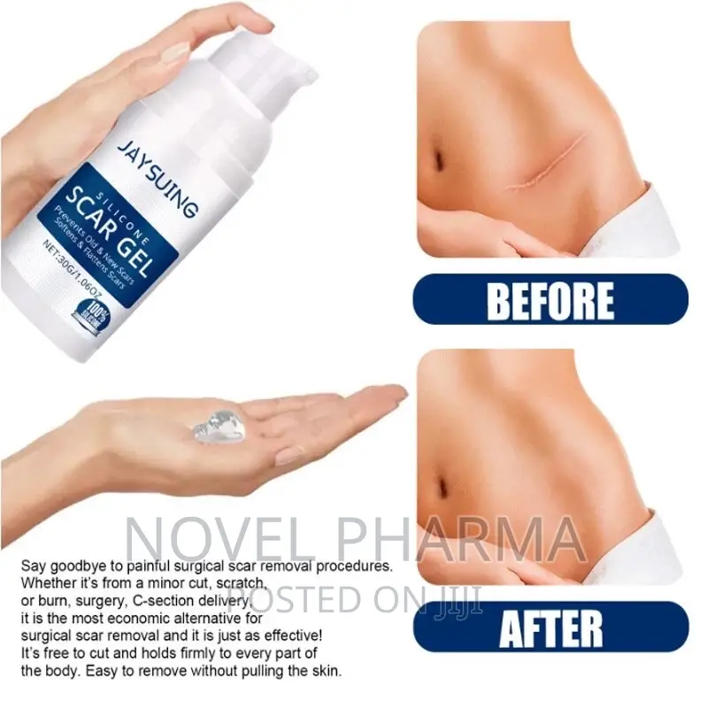Silicone Scar Gel - 30g