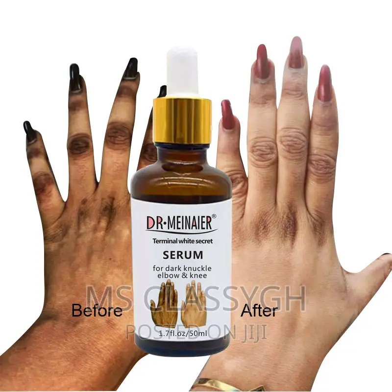 Body Face Whitening Cream Skin Lightening Bleaching Cream