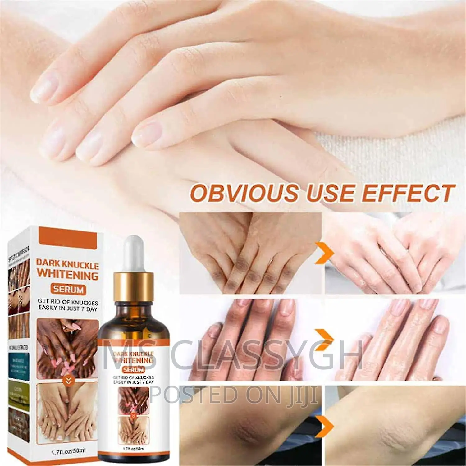 Dark Knuckles Fast Whitening Serum Hand Knuckle Elbows Knee
