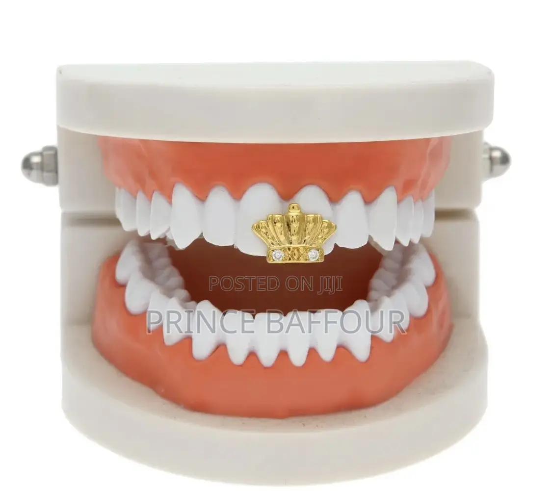 Hip Hop Teeth / Simple Gold Grillz