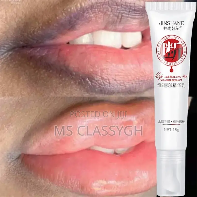 Black Lip Removal Pigmentation Fade Dull Pink Lip Balm Brigh