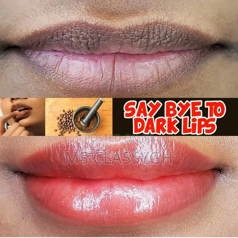 Black Lip Removal Pigmentation Fade Dull Pink Lip Balm Brigh