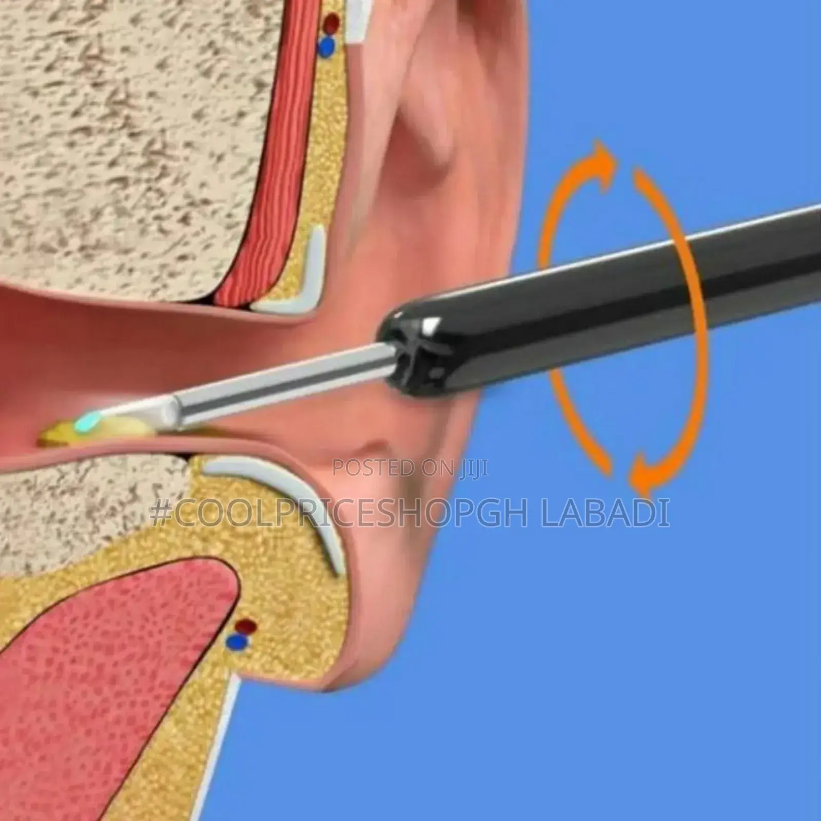 Pinhole Earwax Cleaning Tool