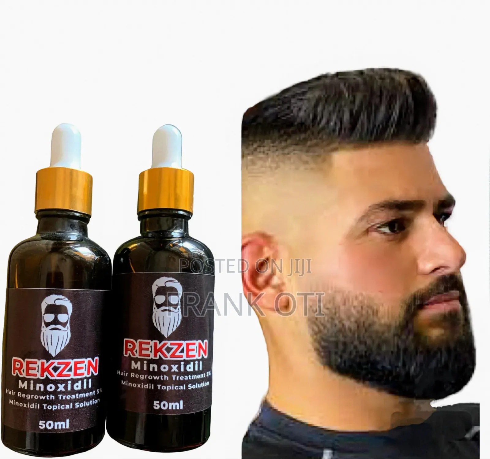 Extra Fast Minoxidil for Hair and Beard