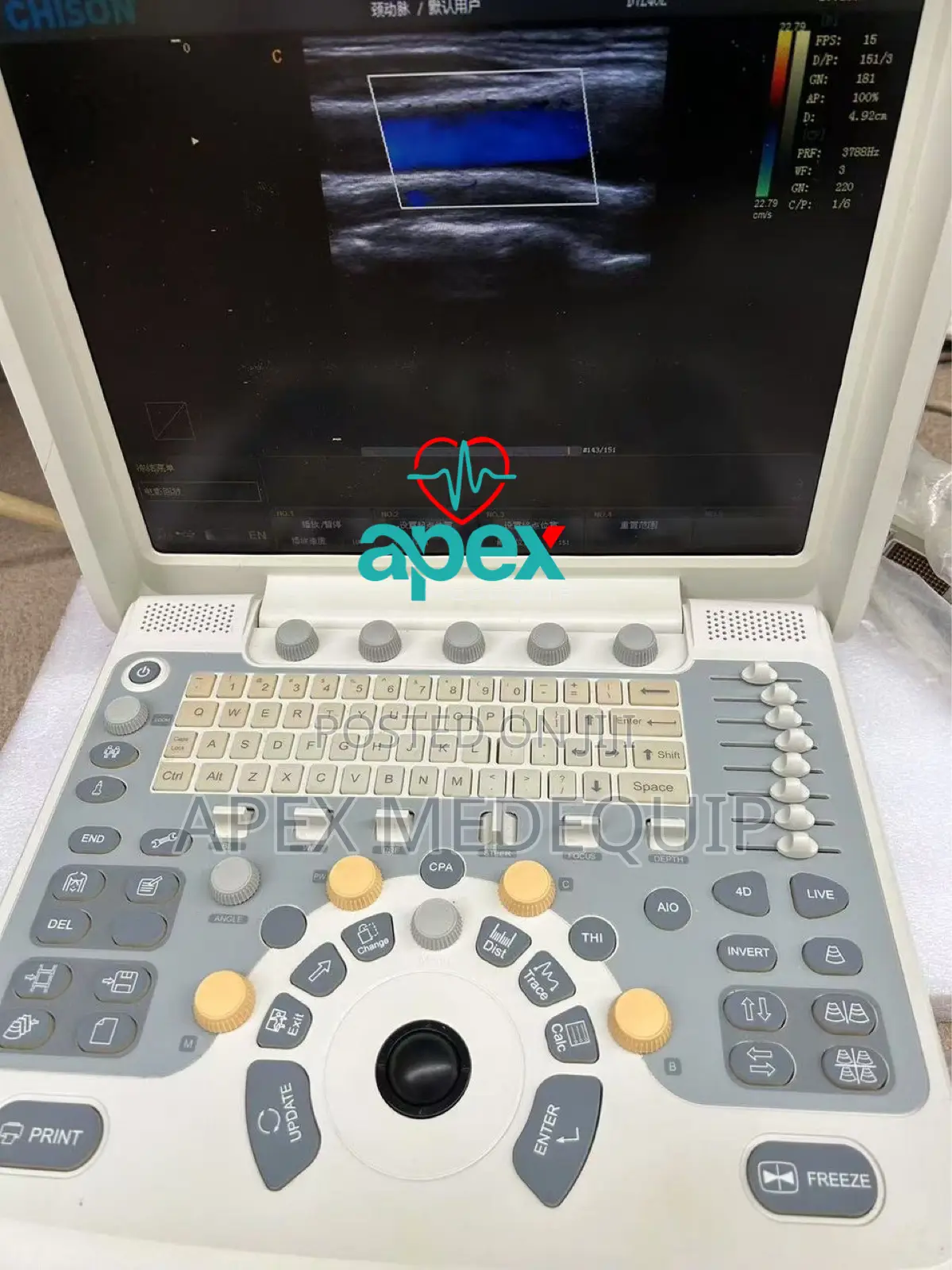 Chison Q5 4d Portable Color Doppler Ultrasound + 3 Probes