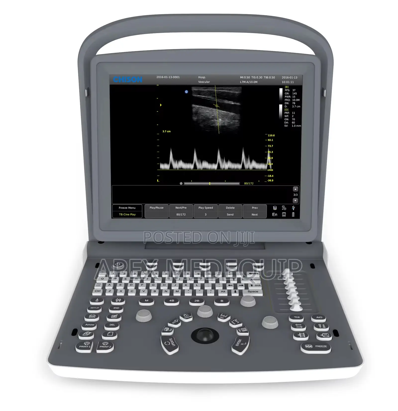 Chison Eco 2 Portable Doppler Ultrasound + Battery