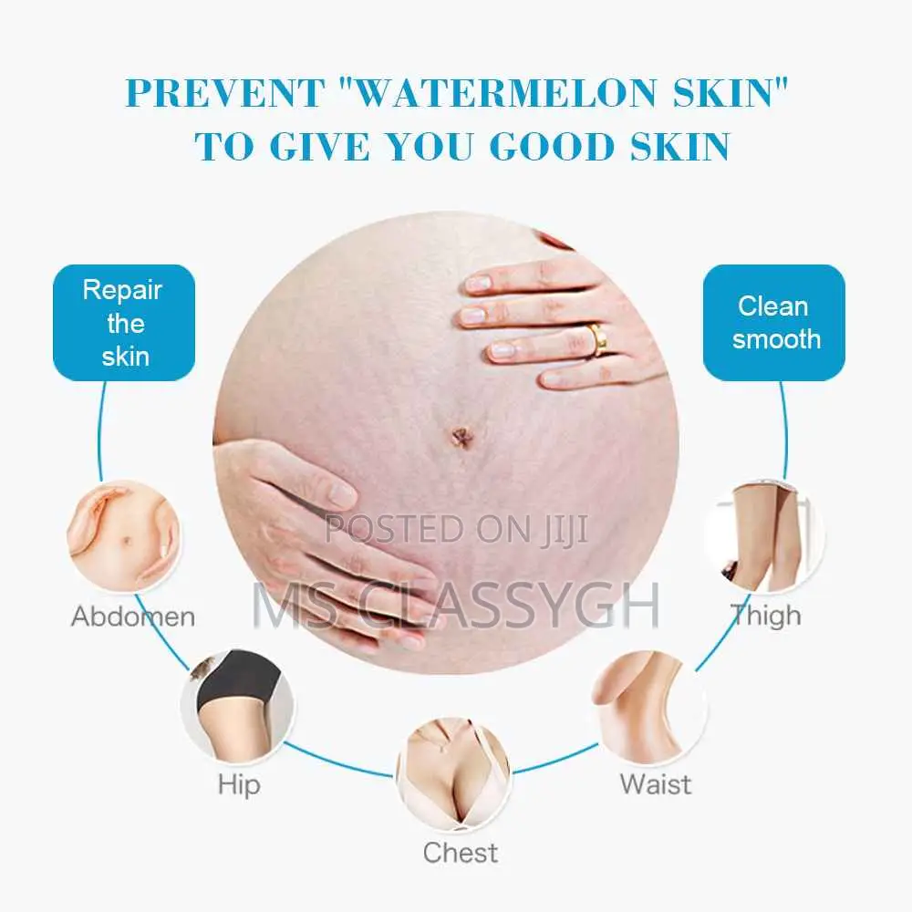 Snail Stretch Mark Cream Removal Stretch Marks Repair Skin