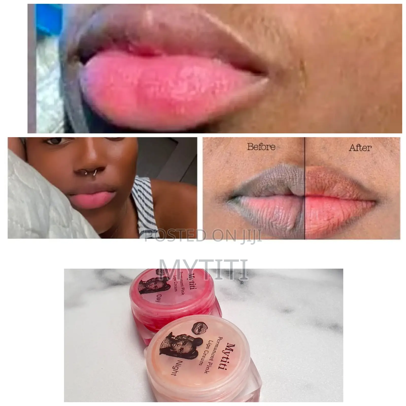 Unisex Pink Lip Therapy (Dark Lips)