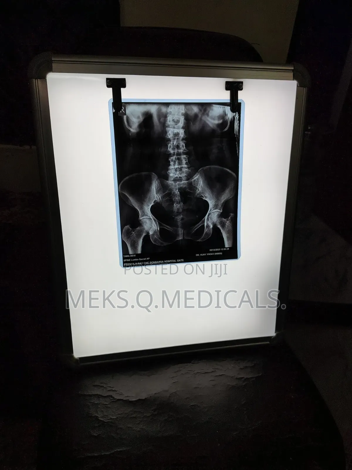 X- Ray View Box Single