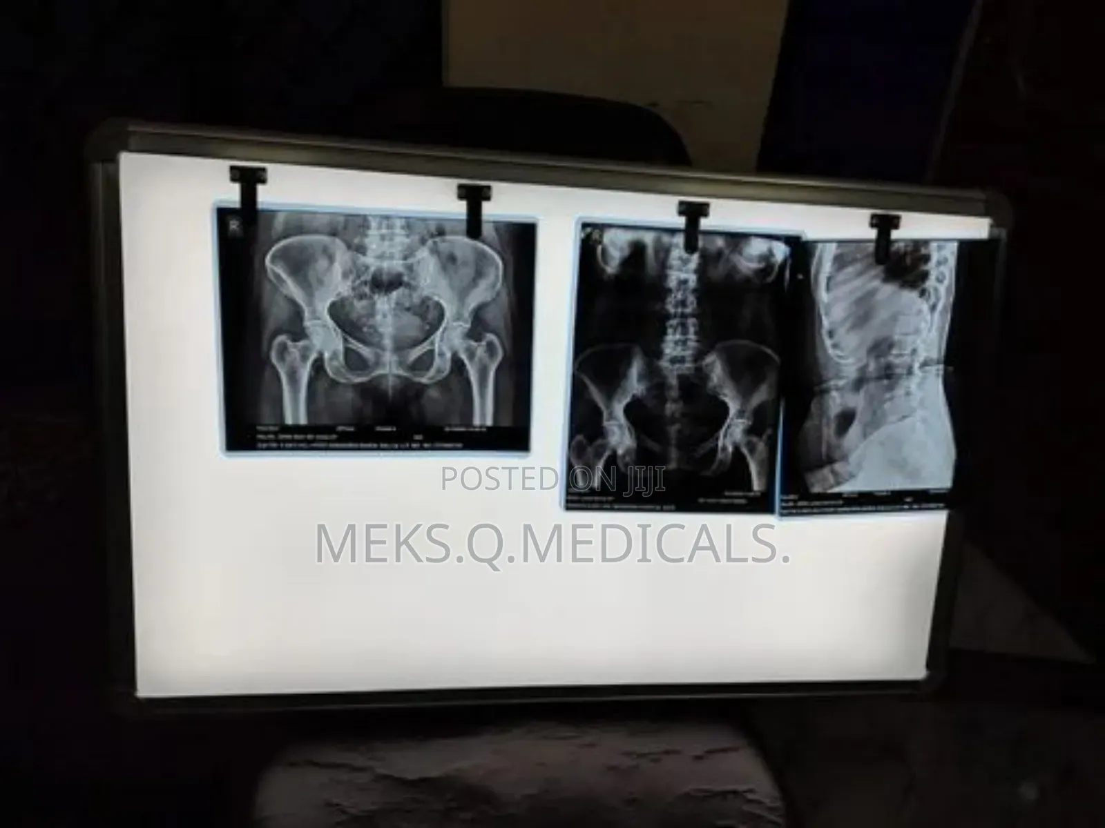 X - Ray View Box Double