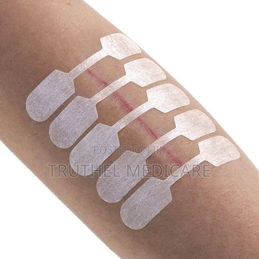 Steri Strips - Skin Closure