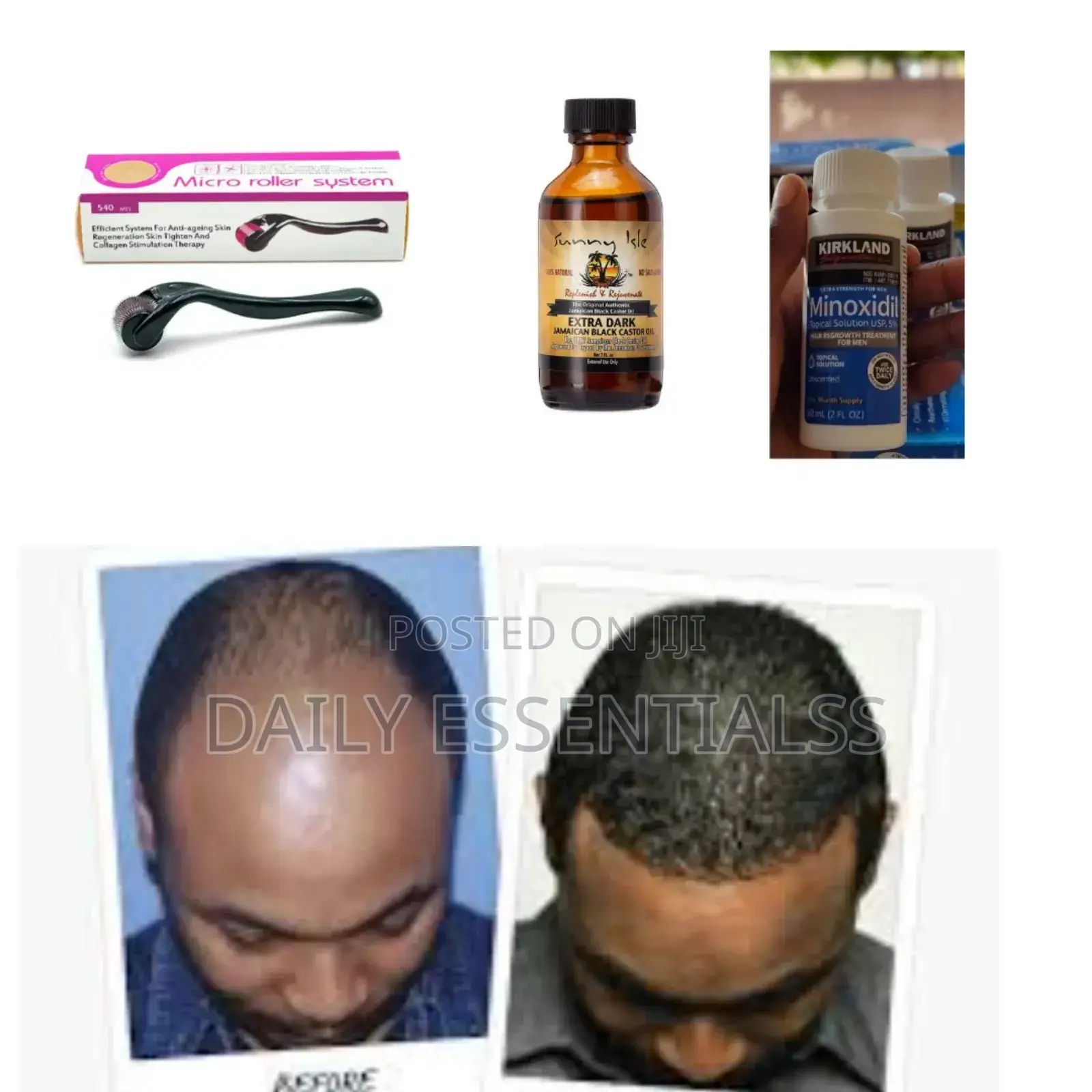 Power Growth Pack – Edges, Crown Beards