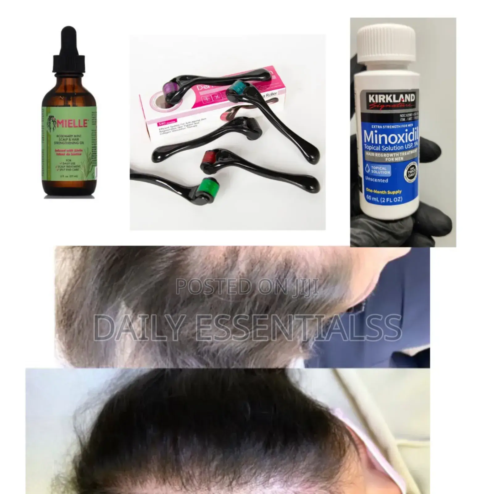 Kirkland X Mielle X Derma Roller Growth Combo