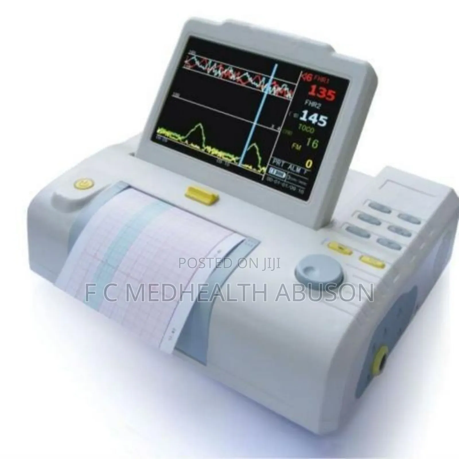 Cardiotocography Machine (Ctg