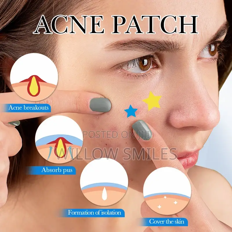 Pimple / Acne Patches (75 Patches)