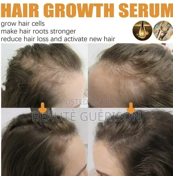 Advanced Biotin Max Vitamin Reviving Serum
