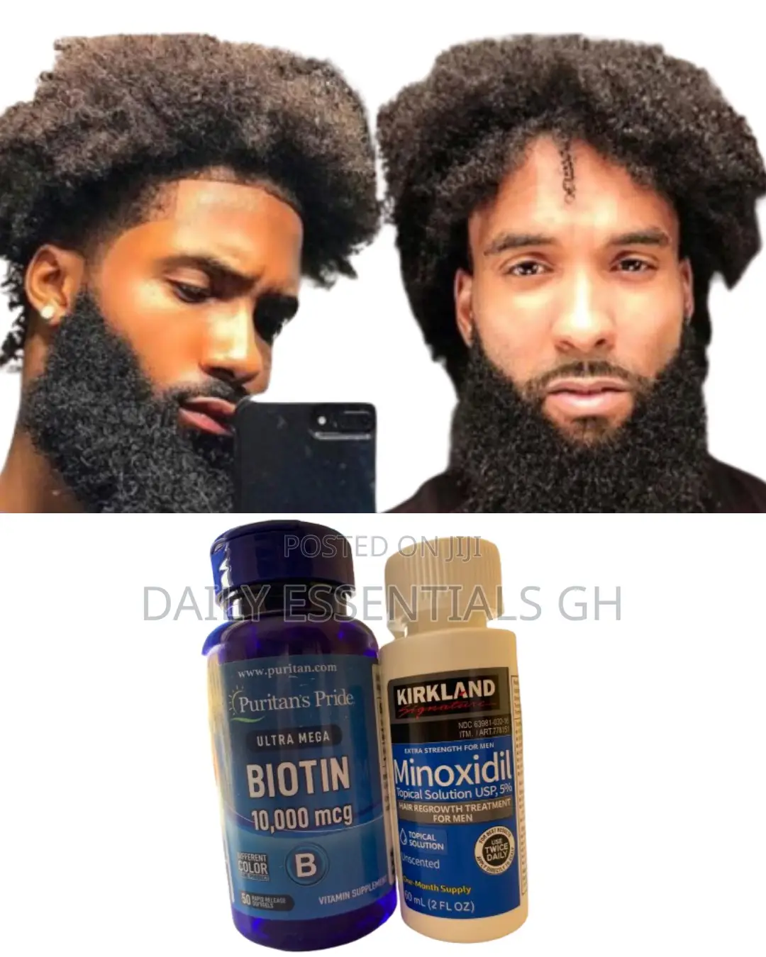 Hair Growth Combo – Kirkland Foam + Biotin + Derma Roller