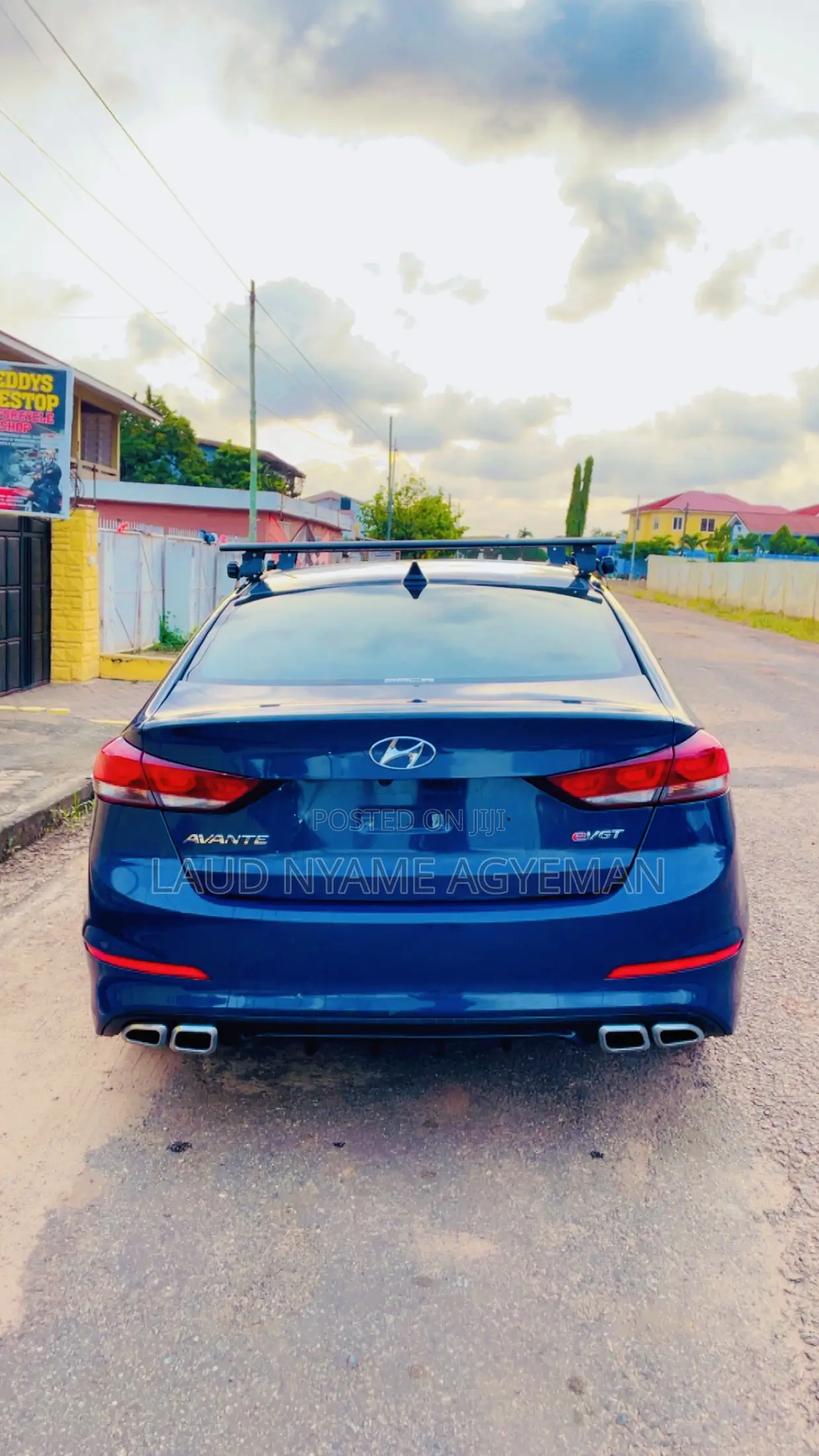 Hyundai Avante 2016 Blue