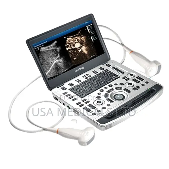 Mindray Dp 10 Ultrasound Scan Machine With Convex and Linear Probes