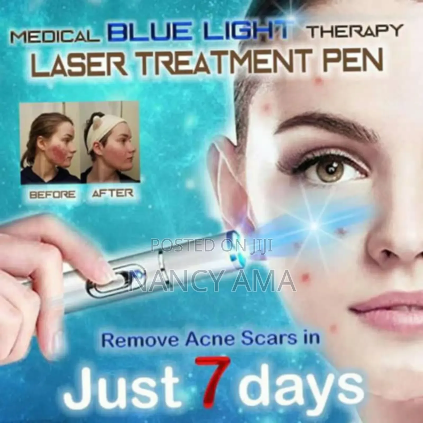 Laser Treatment Therapy Pen