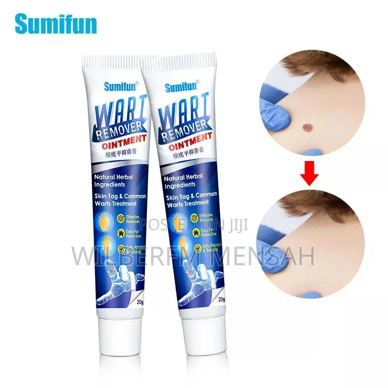 Wart Remover Ointment