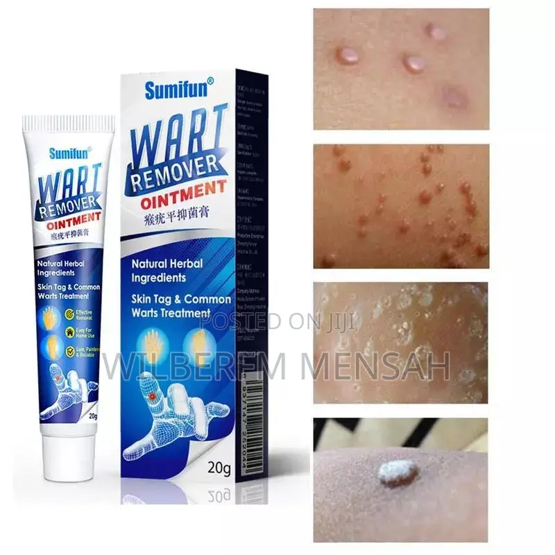 Wart Remover Ointment