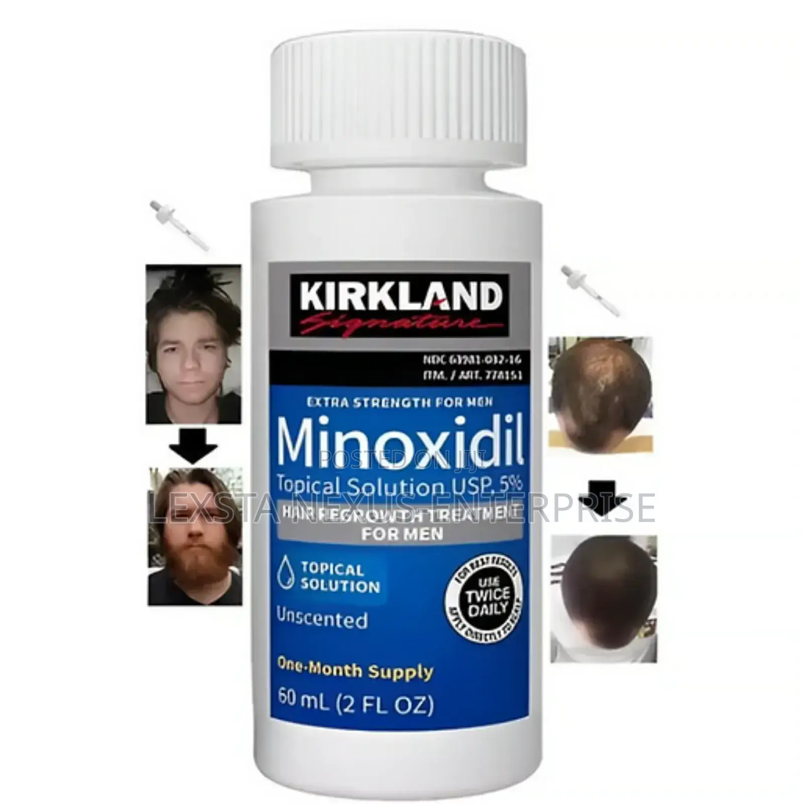 Kirkland Minoxidil Hair Growth