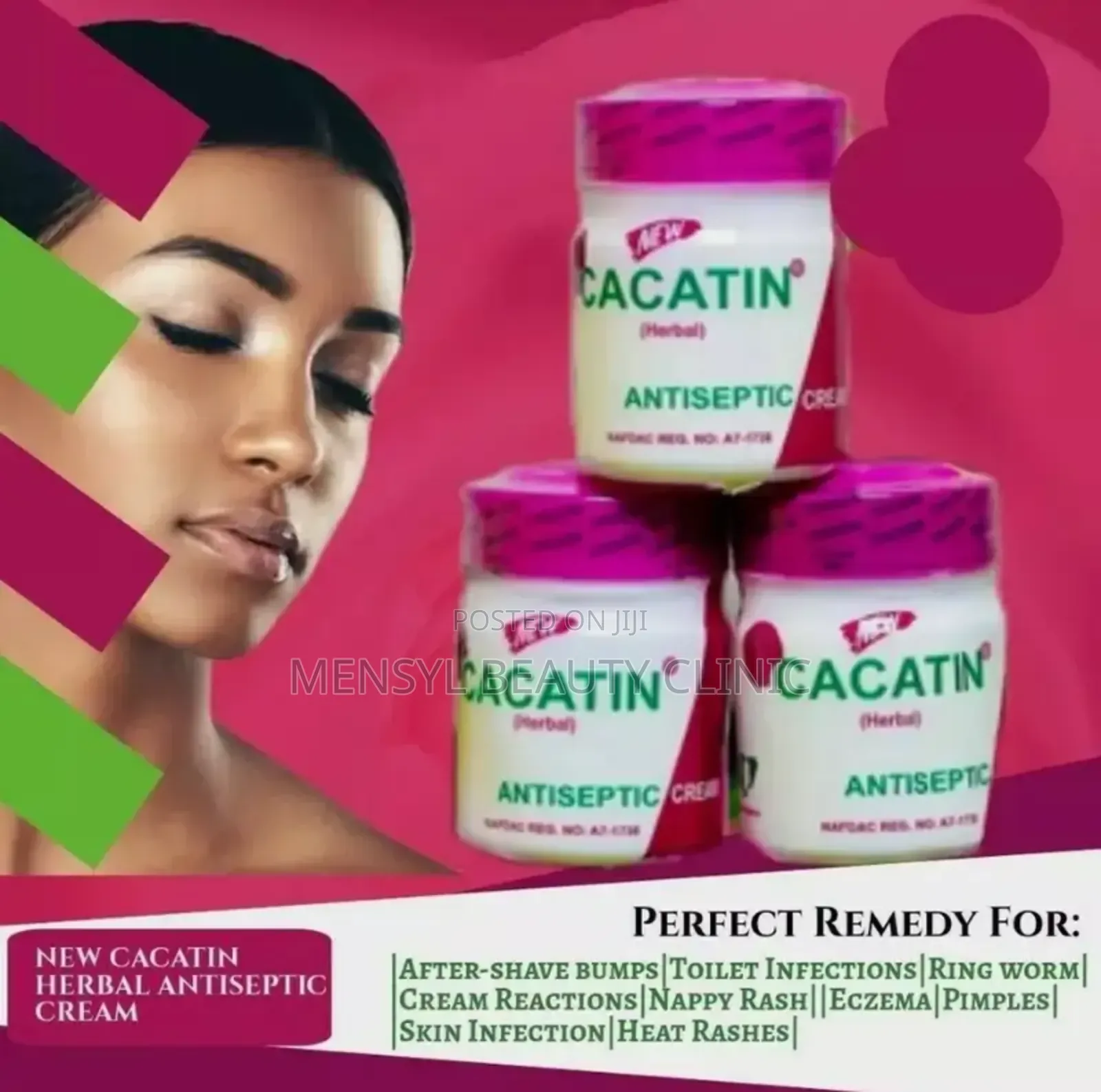 Cacatin Herbal Antiseptic Cream Acne, Eczema, White Patch, and Fungal