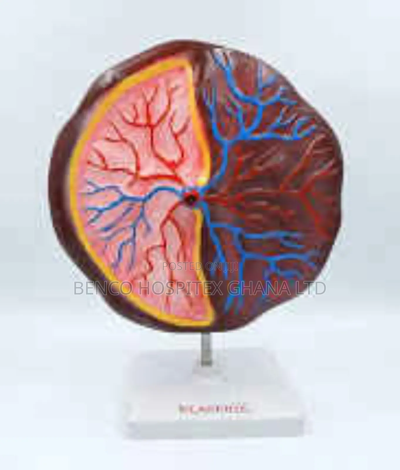 Placenta Model