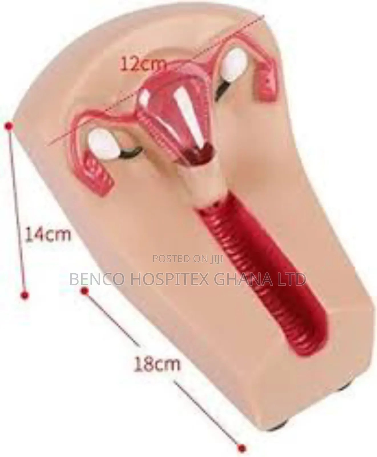 Contraceptive Device Model