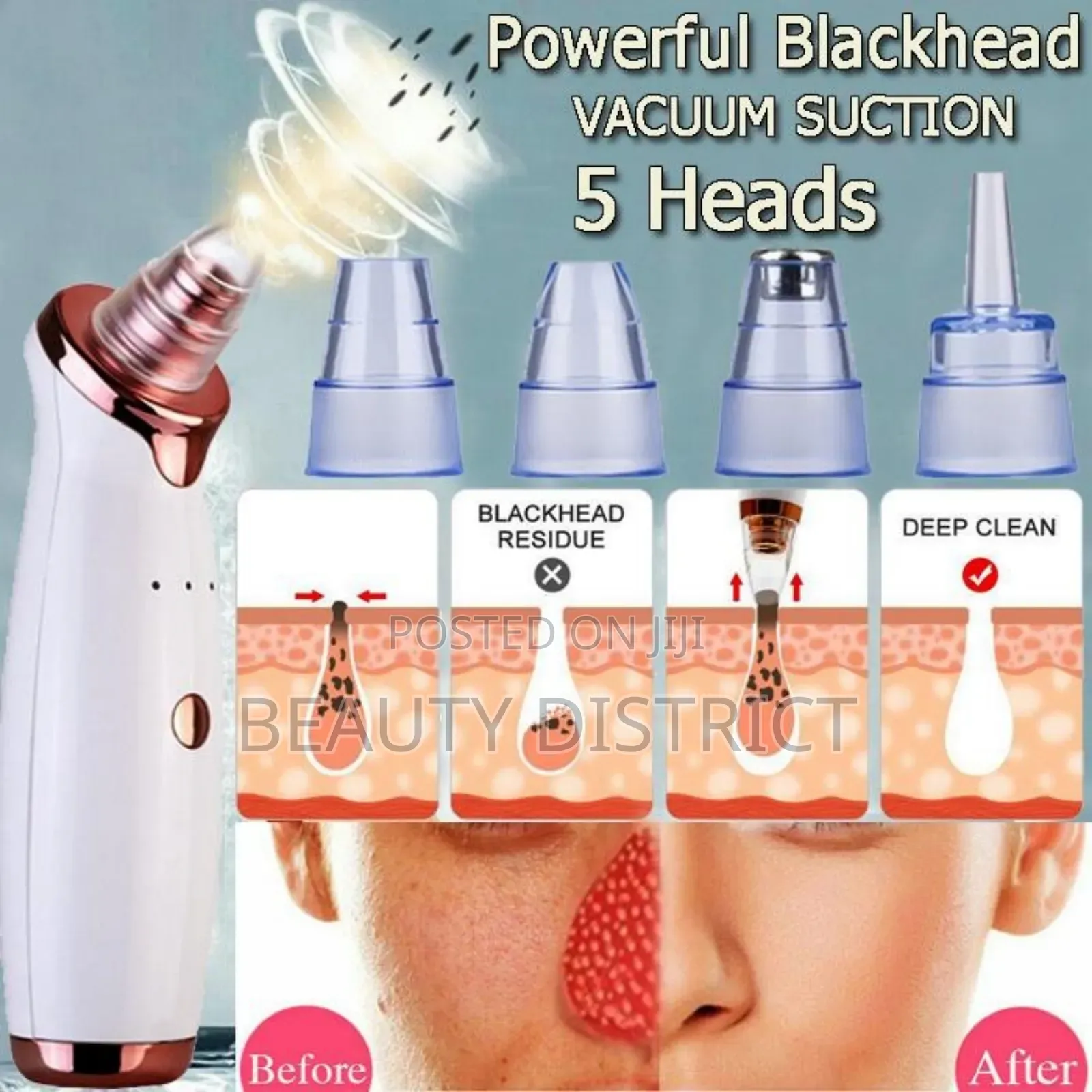 Pore Vacuum