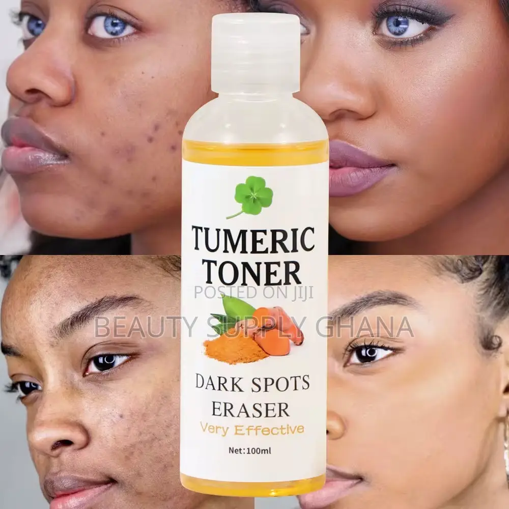 Turmeric Toner – Dark Spots Eraser