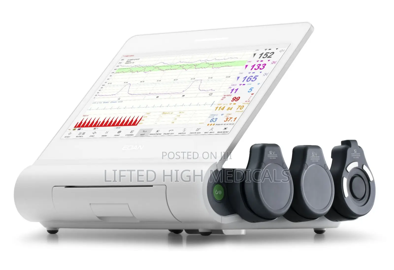 Edan F12 CTG Fetal Monitor for Maternity Labor Wards